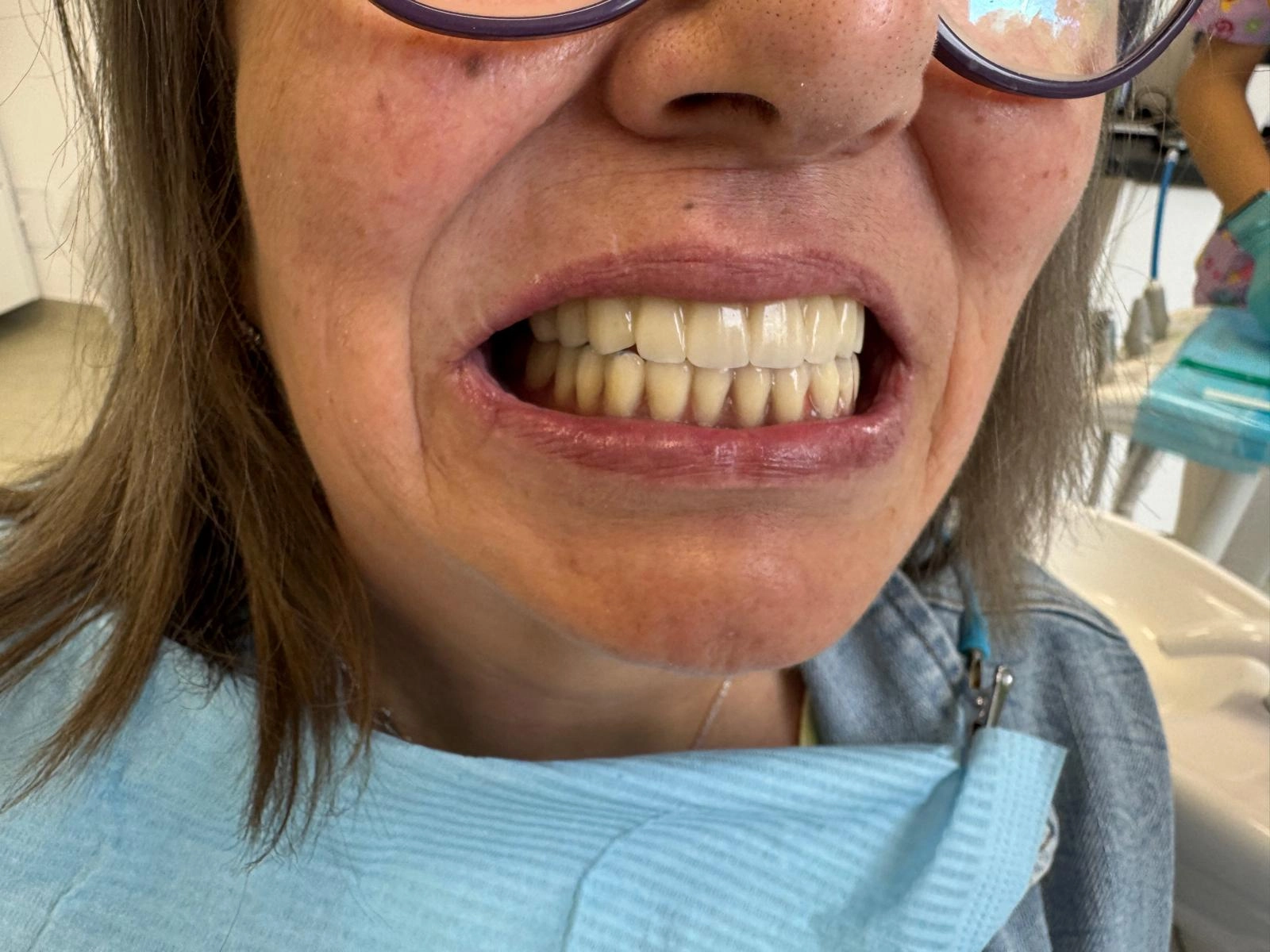 Garantia implanturilor dentare