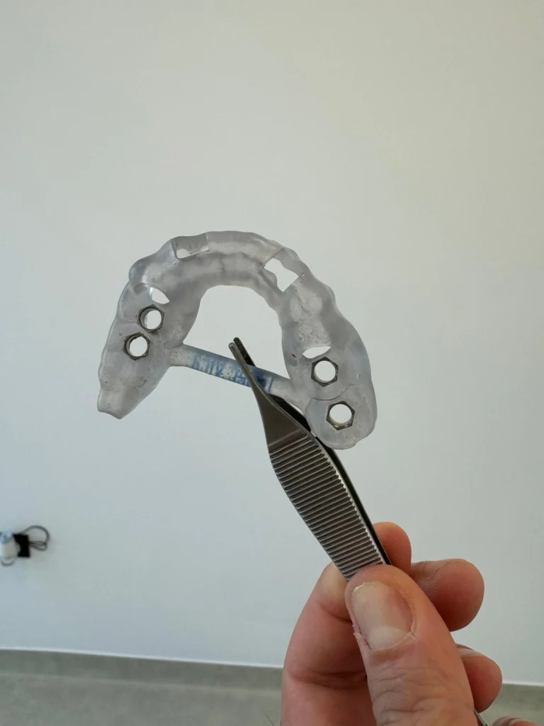 ghid chirurgical pentru inserarea implanturilor dentare