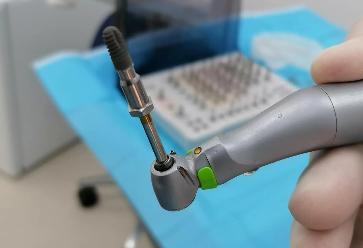 implant dentar