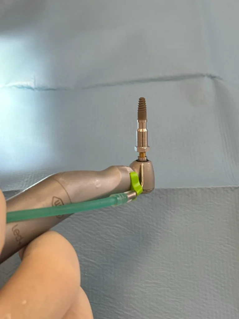 implant dentar